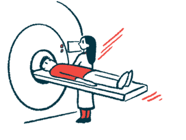 vascular ehlers-danlos syndrome | Ehlers-Danlos News | MRI illustration