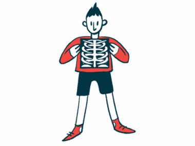 An illustration of a person holding a chest X-ray.