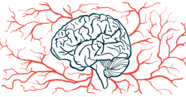 A network of blood vessels is shown around the brain.