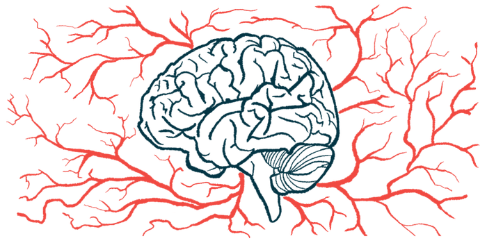 A network of blood vessels is shown around the brain.