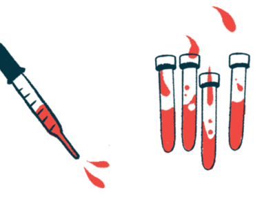 A squirting dropper is pictured alongside four vials each half filled with blood.