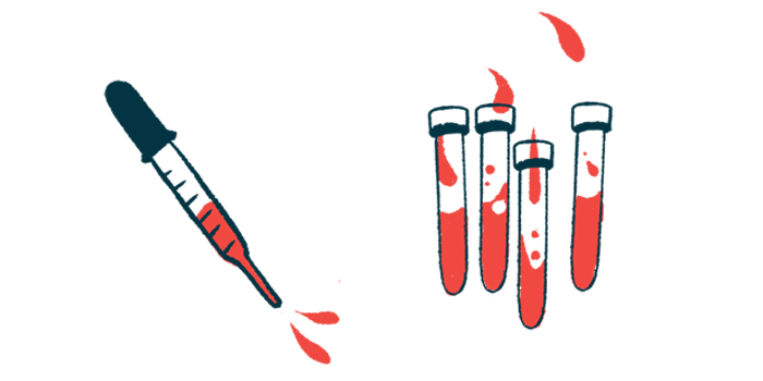 A squirting dropper is pictured alongside four vials each half filled with blood.