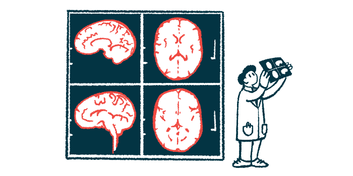 A clinician reviews the results of a brain scan, which is projected on the wall behind him.